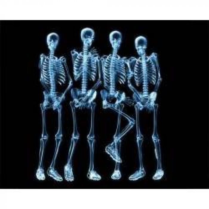 Cyberpunk - СКЕЛЕТ